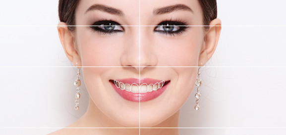 Digital Smile Design (DSD) Digital Smile Design (DSD)